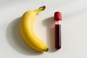 Banane e reni: cosa sapere, chi deve stare attento